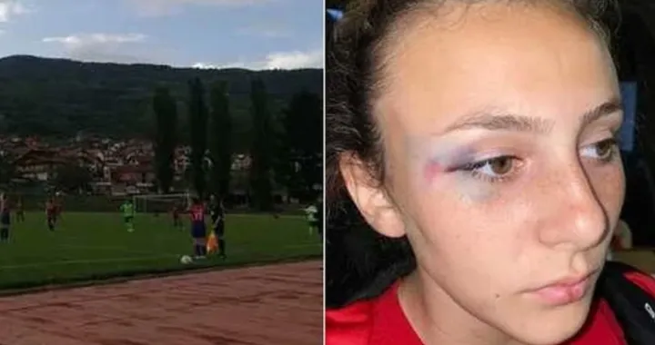 (FOTO) Kad se ženski fudbal u BiH pretvori u tučnjavu: Na&scaron;a Elmina je imala blaži potres mozga...