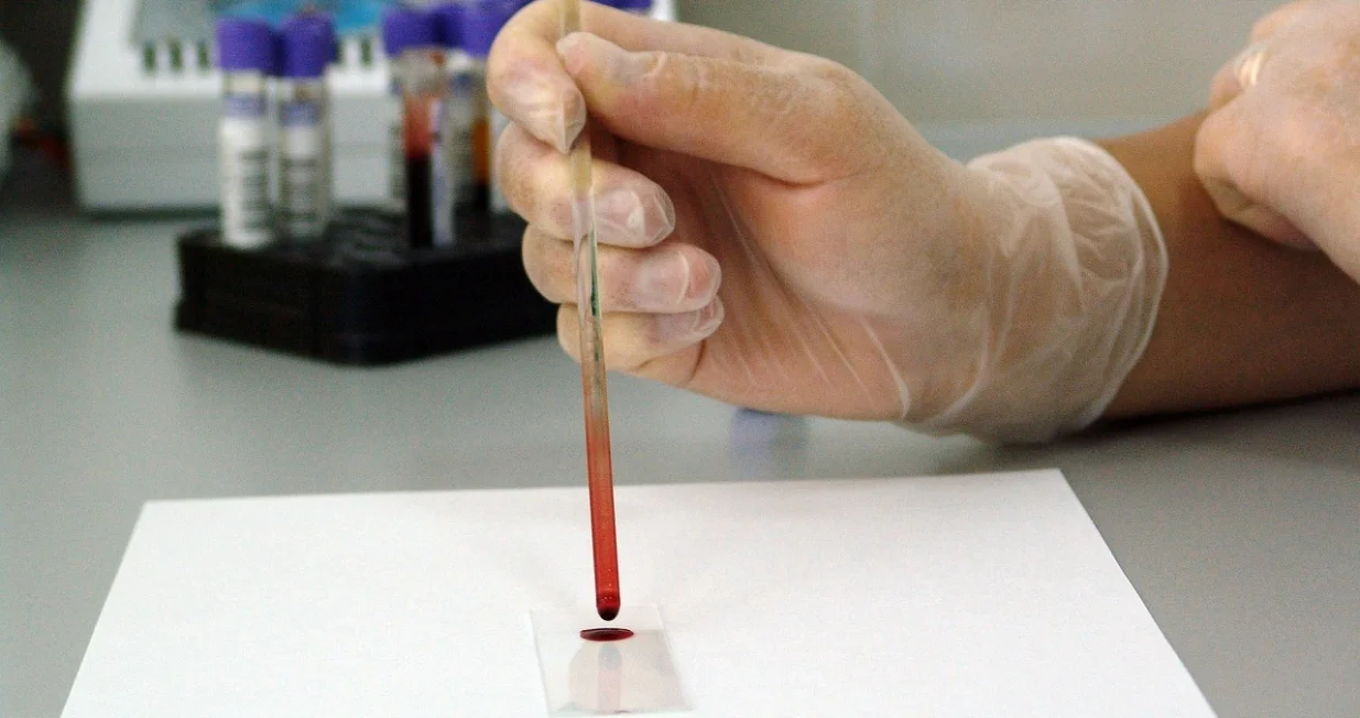 Istraživanje je provedeno u sklopu takozvanog 'globalnog tereta bolesti'/