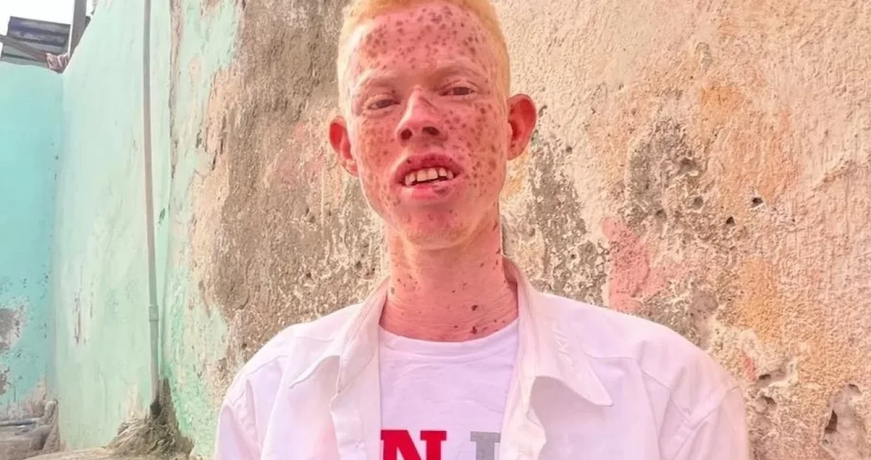 Elmi Bile Mohamed nijemogao iznajmiti ni sobu/BBC/