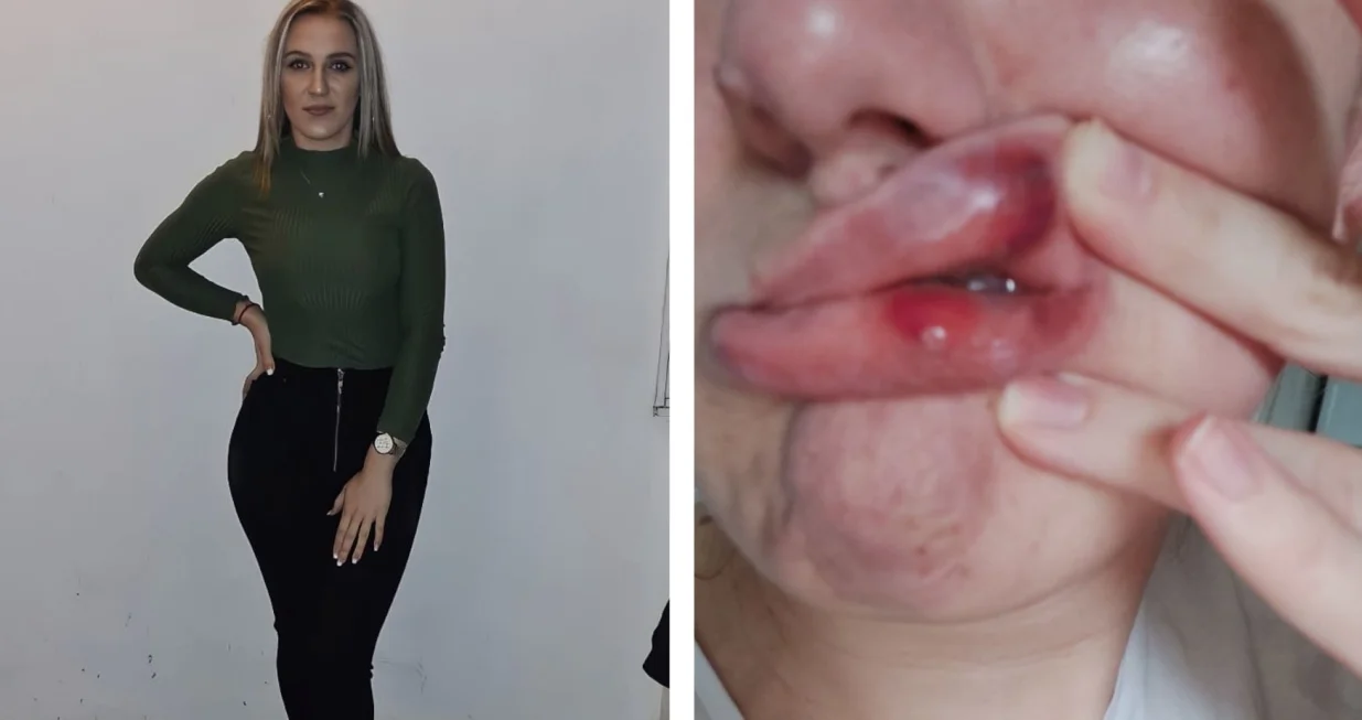 Senaida Muminović, nasilje, bivši suprug, Eldin Bećirović/Namik Šahinpašić