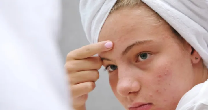 suha koža krema/