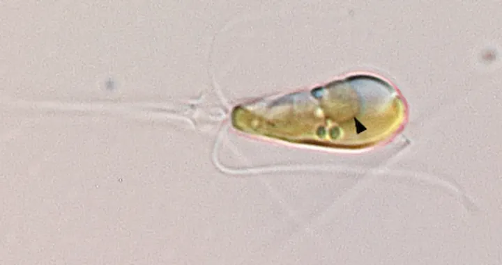 Morska alga Braarudosphaera bigelowii ima stopera u obliku bakterije UCYN-A, koja je evoluirala da postane organela (strelica) unutar ćelije alge.Kredit za sliku: Tyler Coale/UCSC/