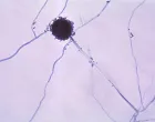 Aspergillus, vrsta plijesni koja može izazvati razne tegobe/Centres For Disease Control And Prevention
