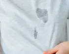 Masne fleke su noćna mora na prvi pogled/Pinterest