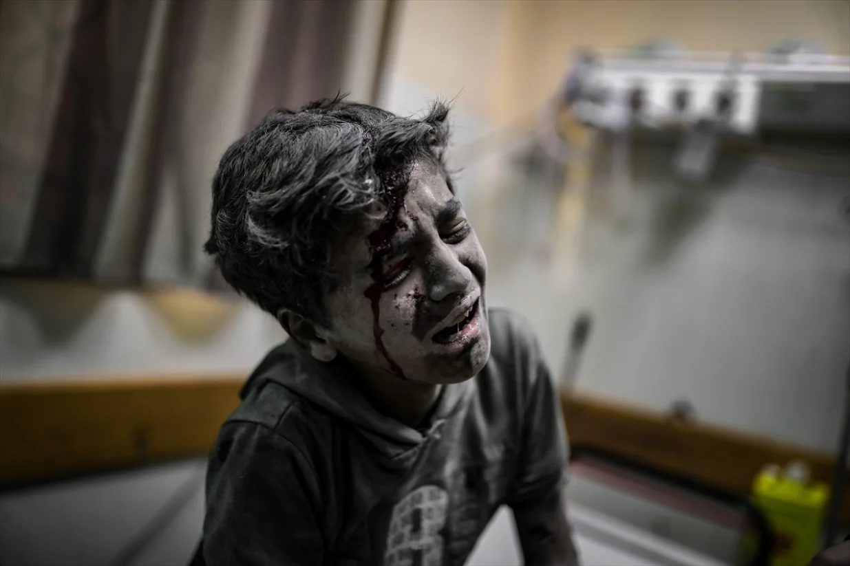 gaza djeca anadolija.jpg/
