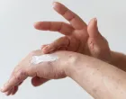 Ovo su najčešći osipi tokom ljeta/Free Pik