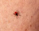 Ugriz krpelja može biti opasan/Pexels