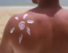 Sunčajte se bez brige/Free Pik