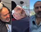 Sejo Sexon za vrijeme i nakon operacije/