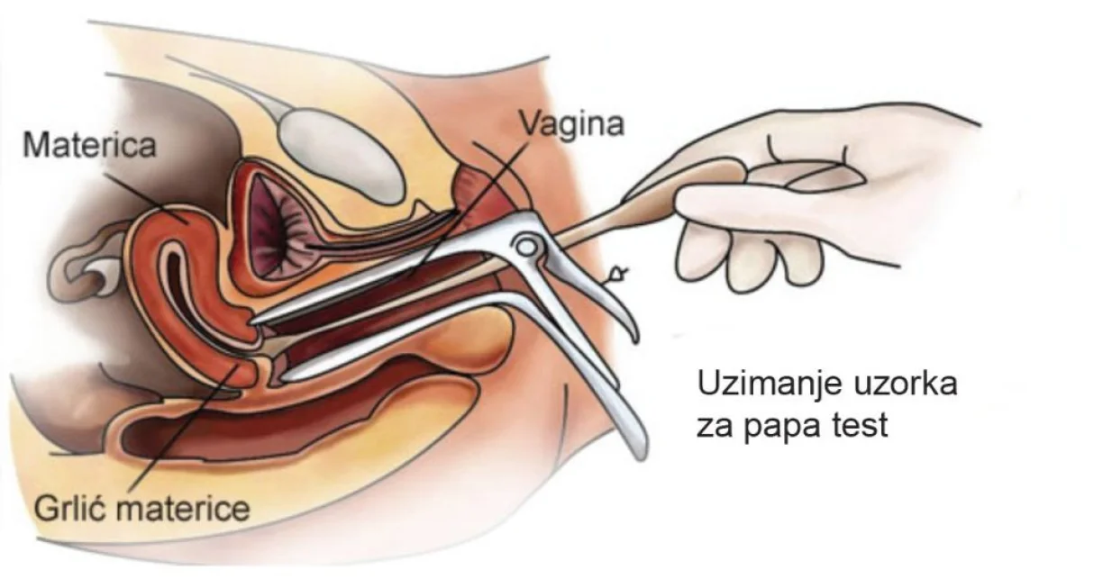 Papa test/