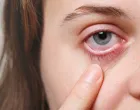 Otkrijte nevidljive uljeze koji remete vaš vid/Free Pik