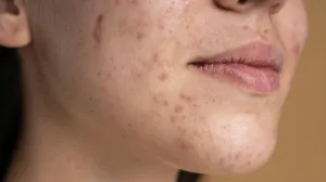 Lijepa koža počinje iznutra/Free Pik