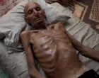 Selim Asfur bori se da preživi/Anadolija/
