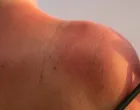 Zadrži sjaj ljeta na koži/Freepik