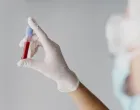 Tajna dugovječnosti krije se u laboratorijskom nalazu/Free Pik