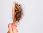 Ovi jednostavni koraci spašavaju kosu/Pinterest