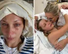 Bella i Yolanda Hadid, lajmska bolest//