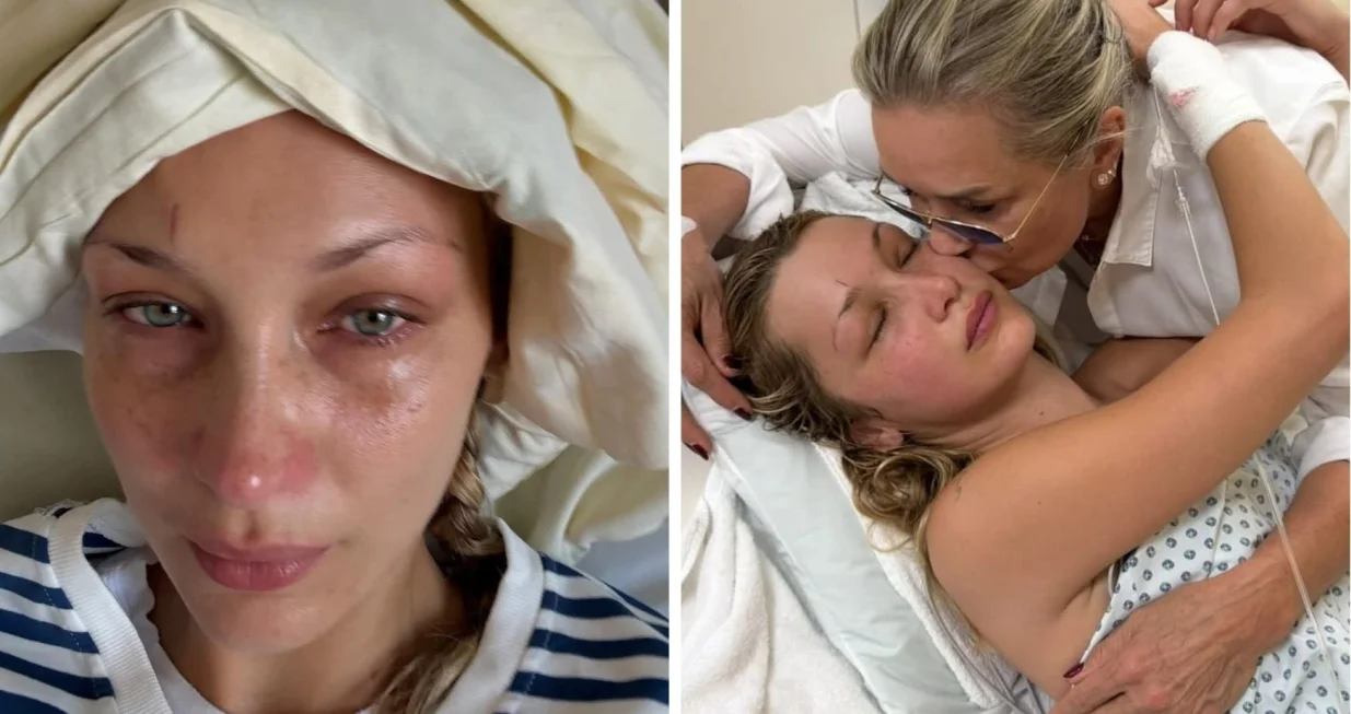 Bella i Yolanda Hadid, lajmska bolest//