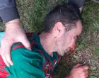 FK Miri Edib Omerović povreda/Foto: