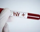 Da li je HIV konačno pobijeđen?/