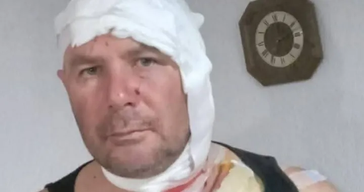 Zadobio povrede/Kakanj-x//