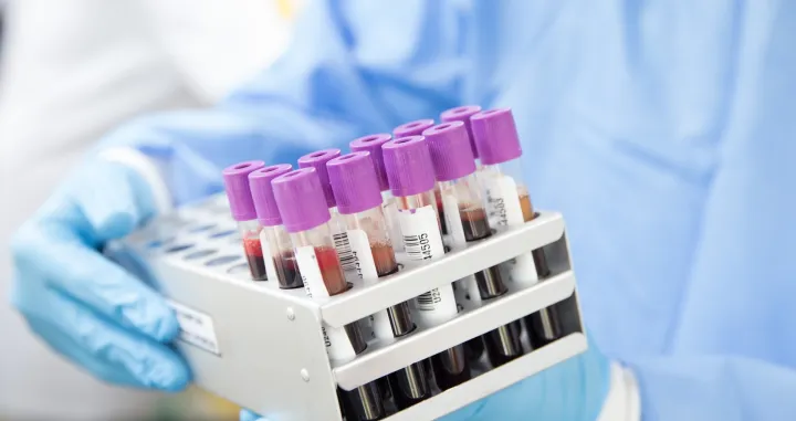 Obećavajući rezultati/Pixabay.com 