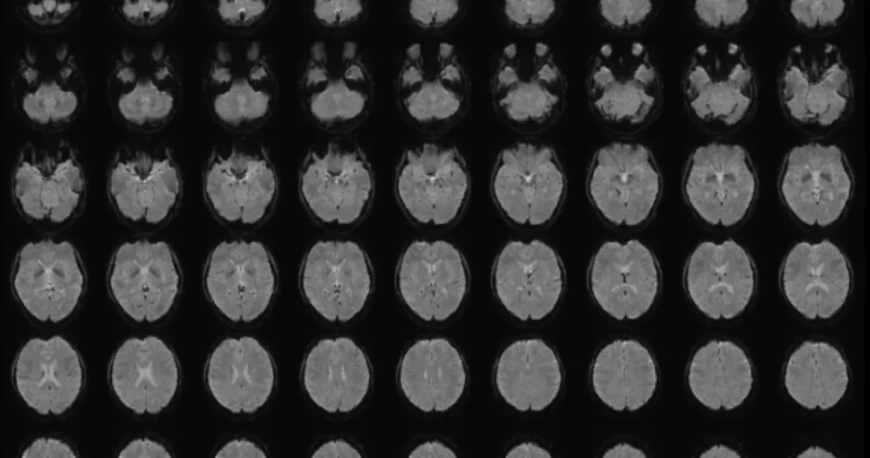 AI je naučila da povezuje obrasce moždane aktivnosti/