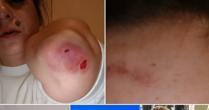 đemila talić gabriel objavila fotografije pretučene kćerke Facebook/Facebook