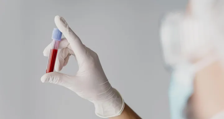 Tajna dugovječnosti krije se u laboratorijskom nalazu/Free Pik