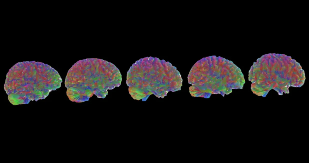 Pet moždanih doba: djetinjstvo, adolescencija, odrasla dob, rano starenje i kasno starenje.Zasluge za sliku: Dr. Alexa Mousley, Univerzitet u Cambridgeu; modificirano od strane IFLScience/