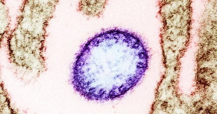 Virus Nipah/Ilustracija/Wikimedia/