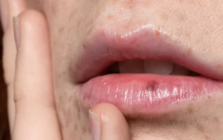 Ne riskirajte zdravlje/Free Pik