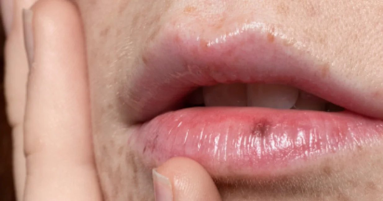 Ne riskirajte zdravlje/Free Pik