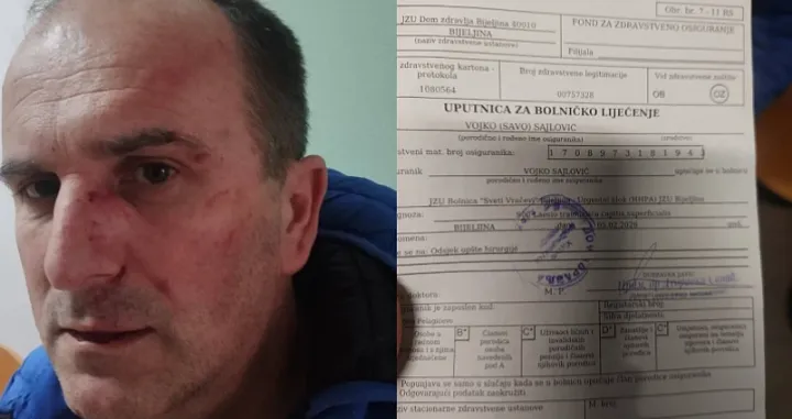 Vojko Sajlović, aktivista SDS-a, brutalno pretučen/