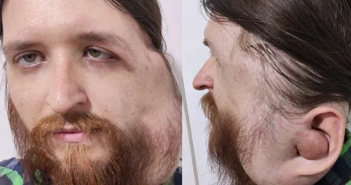 Jasenko Ramić, apel za pomoć, Pomozi.ba/