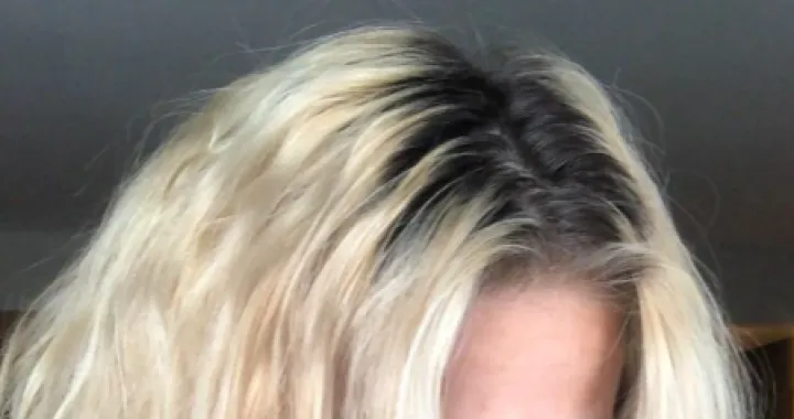 Zbogom ružnom izrastku/Pinterest