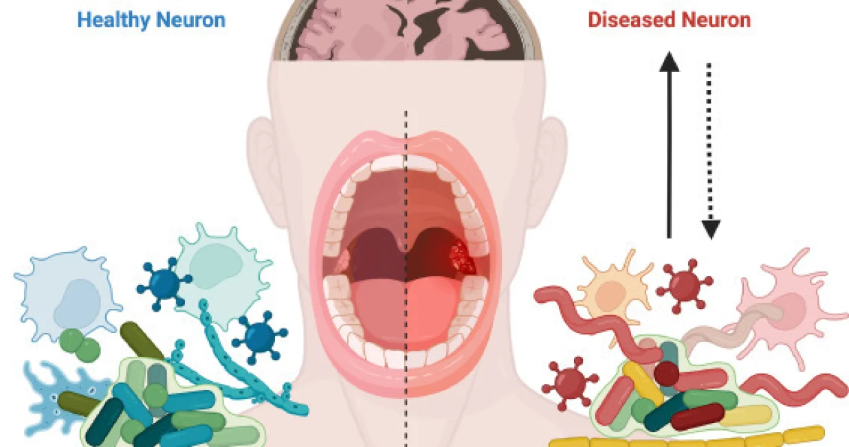 Važno je da su desni zdrave/ScienceDirect/