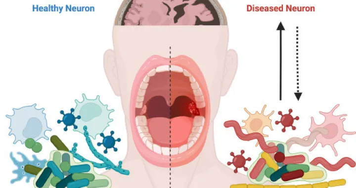 Važno je da su desni zdrave/ScienceDirect/