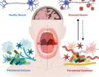 Važno je da su desni zdrave/ScienceDirect/