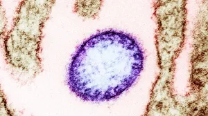 Virus Nipah/Ilustracija/Wikimedia/