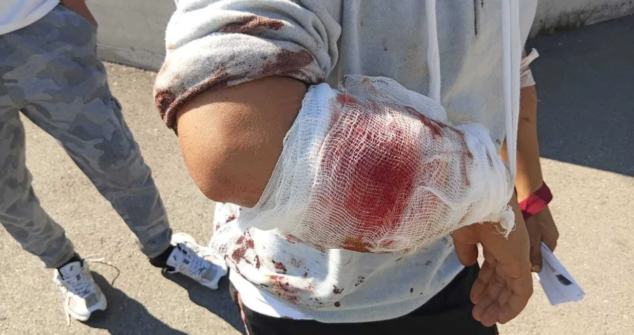 Migrant kojeg su napali hrvatski granični psi/